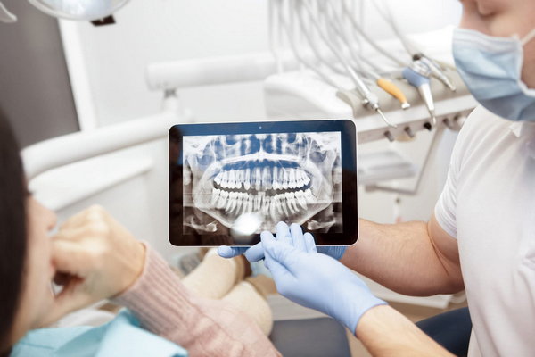 Какие бывают стоматологические рентген-аппараты?