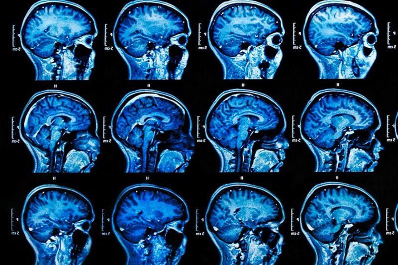 Ученые выяснили, как мозг обрабатывает абстрактные понятия