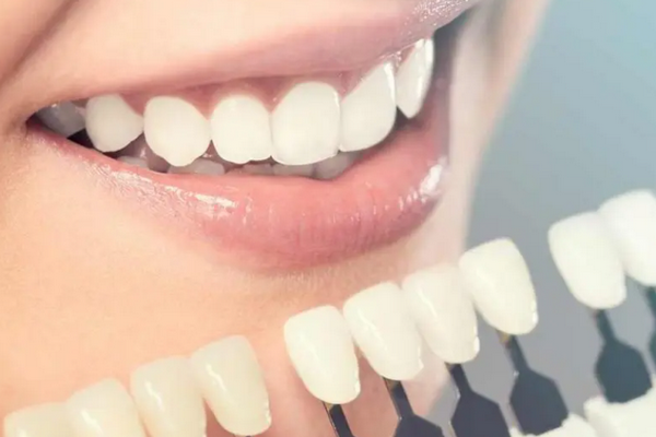 Специалист рассказала о продуктах, влияющих на цвет зубов