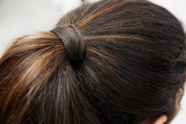 Повышенная жирность волос. Причины и лечение